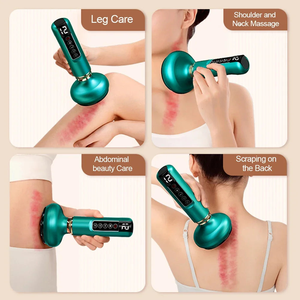Cupping Fat Burner Anti-Cellulite Thermal Massage