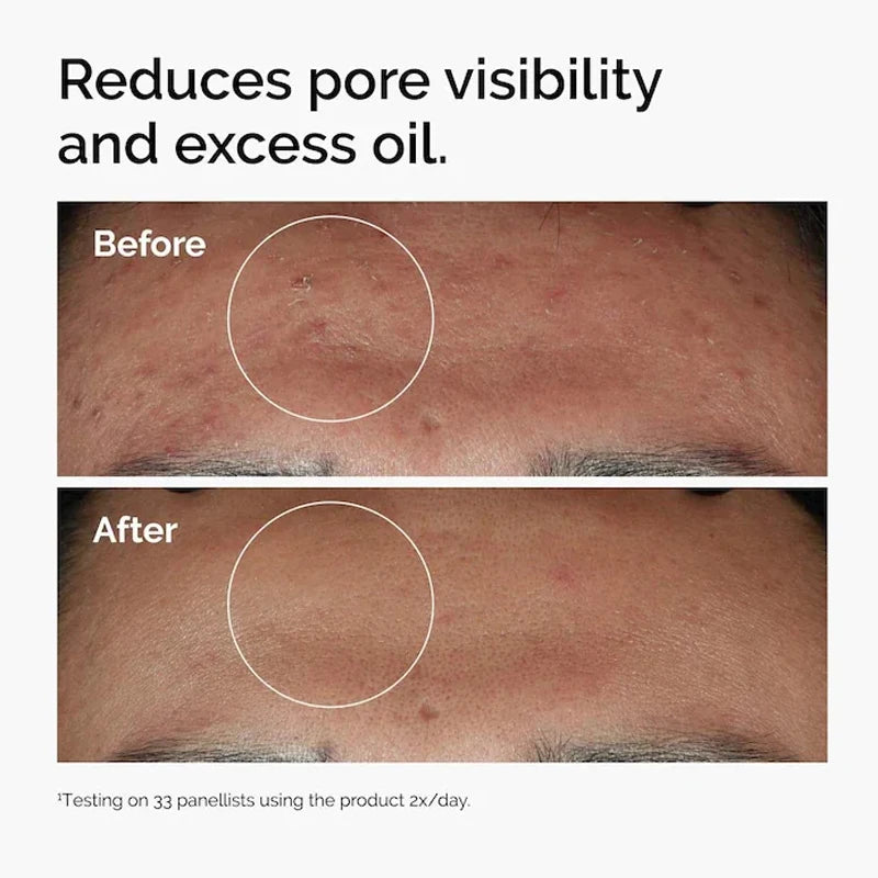 multi effect serum